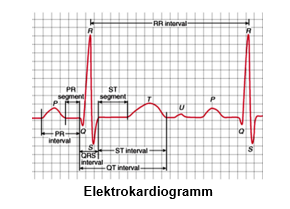 publication-elektrocardiogramm